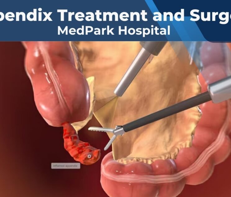 Appendix Treatment and Surgery at MedPark Hospital