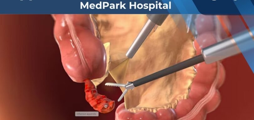 Appendix Treatment and Surgery at MedPark Hospital