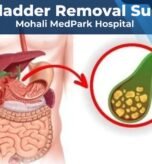 gallbladder removal surgery mohali