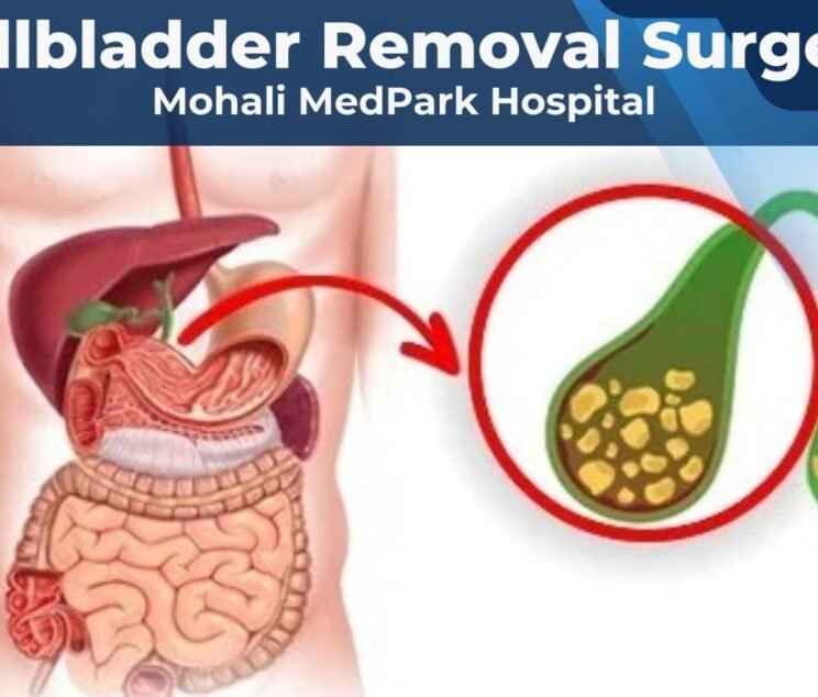 gallbladder removal surgery mohali