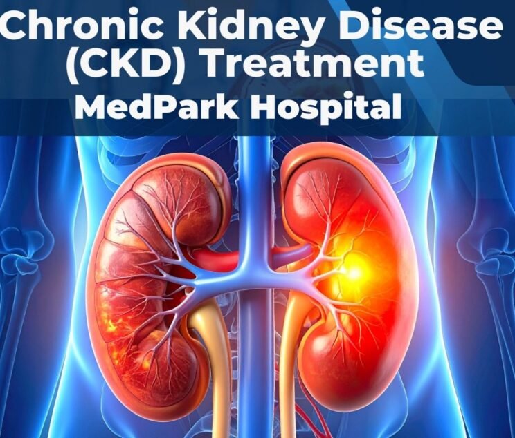 Kidney treatment in Chandigarh