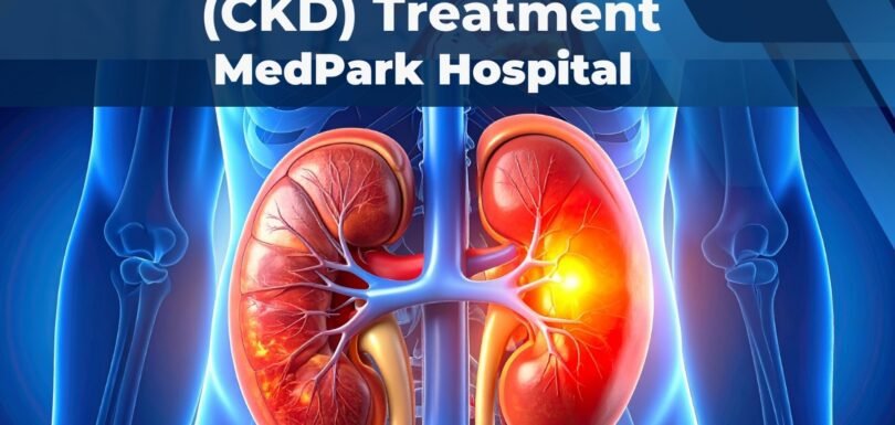 Kidney treatment in Chandigarh