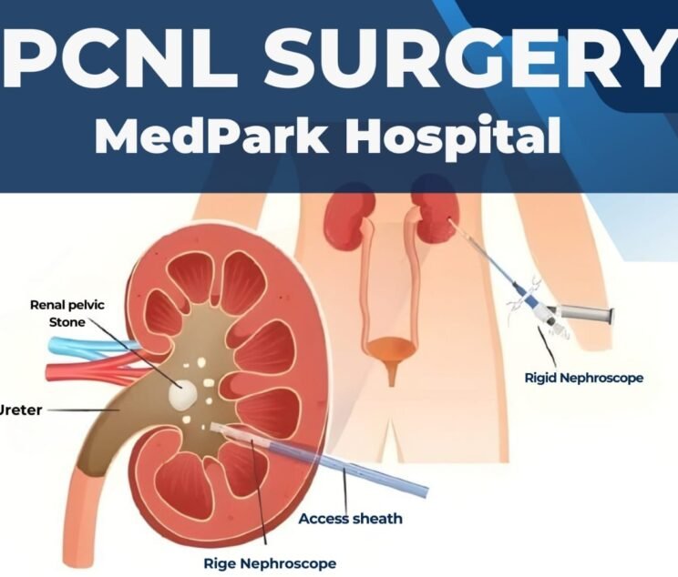 PCNL Surgery mohali