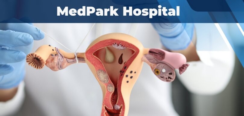 PCOD Treatment Mohali