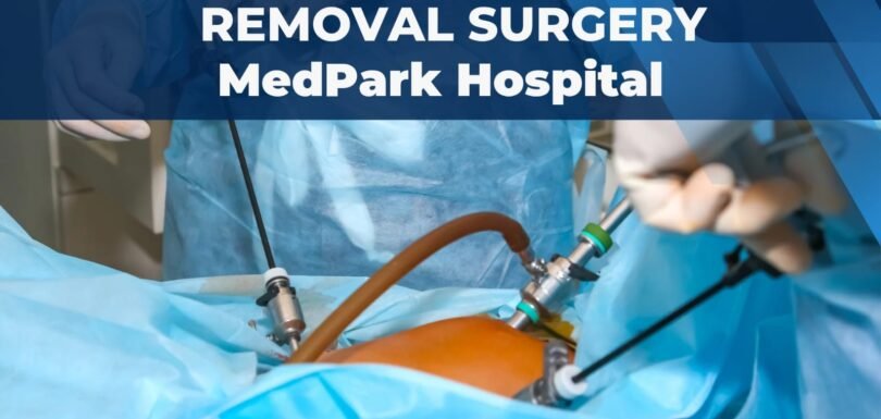 gallbladder removal surgery mohali